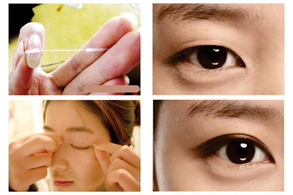 Sử dụng chỉ tạo mắt hai mí cũng là cách giúp mắt to tròn đẹp tự nhiên