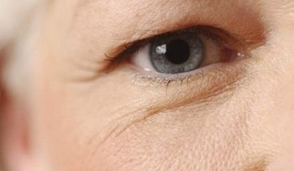 Giải pháp cứu vãn tình trạng sụp mí mắt ở người già